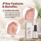 Feet Corn Removal Serum (30ml)